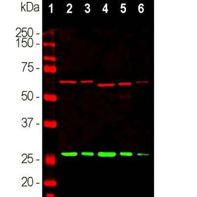 Western Blot: Calretinin Antibody [NBP2-50029]