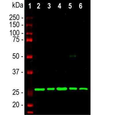 Western Blot: Calretinin Antibody [NBP3-05530]