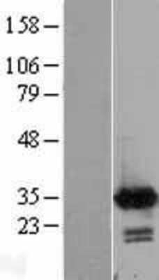 Western Blot: Calretinin Overexpression Lysate [NBL1-08641]