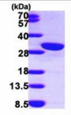 SDS-PAGE: Recombinant Human Calretinin His Protein [NBP1-48344]