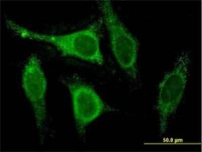 Immunocytochemistry/ Immunofluorescence: Calsenilin Antibody (2B3-A1) [H00030818-M01]