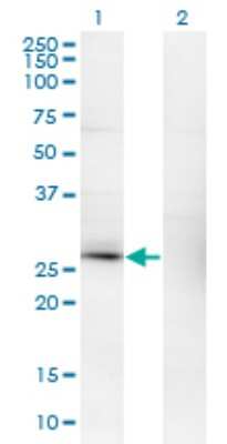 Western Blot: Calsenilin Antibody (2B3-A1) [H00030818-M01]