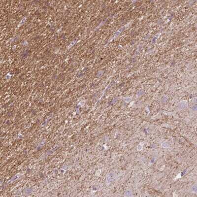 Immunohistochemistry-Paraffin: Calsenilin Antibody [NBP2-57209]