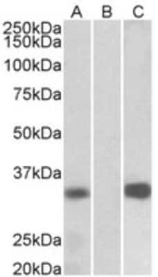 Western Blot: Calsenilin Antibody [NBP2-26111]