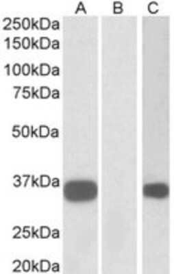 Western Blot: Calsenilin Antibody [NBP2-26112]