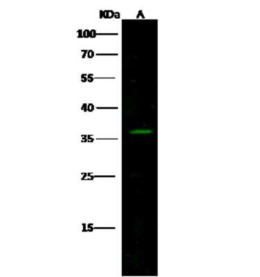 Western Blot: Calsenilin Antibody [NBP3-00359]