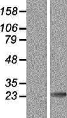 Western Blot: Calsenilin Overexpression Lysate [NBP2-10609]