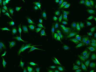 Immunocytochemistry/ Immunofluorescence: Calsequestrin 1 Antibody [NBP3-00194]