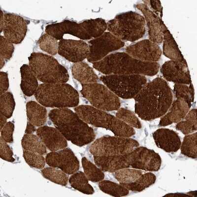 Immunohistochemistry-Paraffin: Calsequestrin 1 Antibody [NBP1-88180]