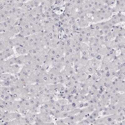 Immunohistochemistry-Paraffin: Calsequestrin 1 Antibody [NBP1-88180]