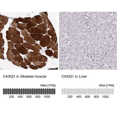 Immunohistochemistry-Paraffin: Calsequestrin 1 Antibody [NBP1-88180]