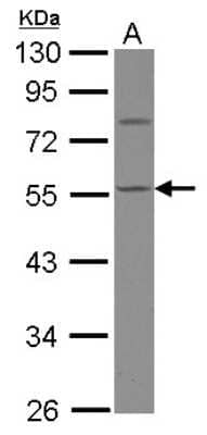 Western Blot: Calsequestrin 1 Antibody [NBP2-15682]