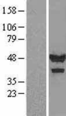 Western Blot: Calsequestrin 1 Overexpression Lysate [NBL1-08719]