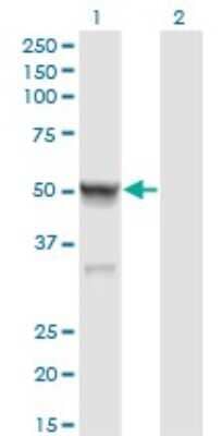 Western Blot: Calsequestrin 2 Antibody (1B6) [H00000845-M01]