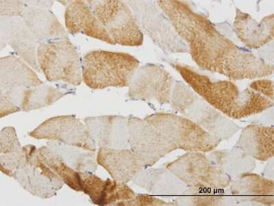 Immunohistochemistry-Paraffin: Calsequestrin 2 Antibody (1C6) [H00000845-M07]