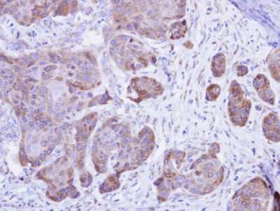 Immunohistochemistry-Paraffin: Calsequestrin 2 Antibody [NBP1-32594]