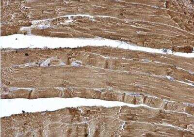 Immunohistochemistry-Paraffin: Calsequestrin 2 Antibody [NBP1-32594]