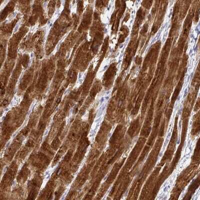 Immunohistochemistry-Paraffin: Calsequestrin 2 Antibody [NBP1-87304]