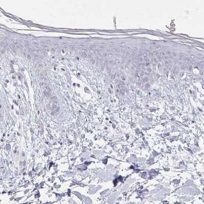 Immunohistochemistry-Paraffin: Calsequestrin 2 Antibody [NBP1-87304]