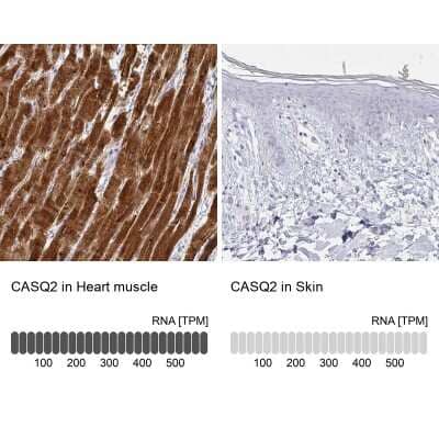 Immunohistochemistry-Paraffin: Calsequestrin 2 Antibody [NBP1-87304]