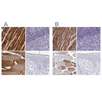 Immunohistochemistry-Paraffin: Calsequestrin 2 Antibody [NBP1-87304]