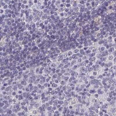 Immunohistochemistry-Paraffin: Calsequestrin 2 Antibody [NBP1-87304]