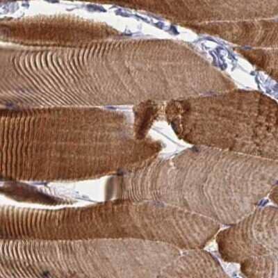 Immunohistochemistry-Paraffin: Calsequestrin 2 Antibody [NBP1-87304]