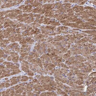 Immunohistochemistry-Paraffin: Calsequestrin 2 Antibody [NBP2-33747]