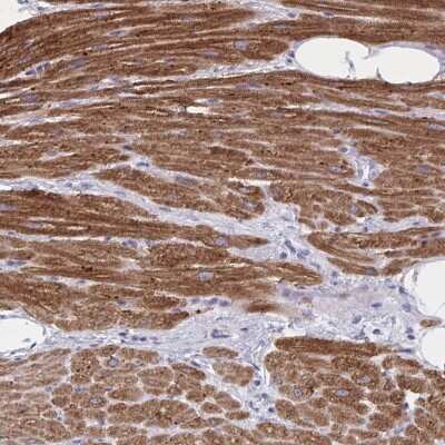 Immunohistochemistry-Paraffin: Calsequestrin 2 Antibody [NBP2-33747]
