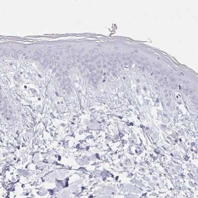 Immunohistochemistry-Paraffin: Calsequestrin 2 Antibody [NBP2-33747]