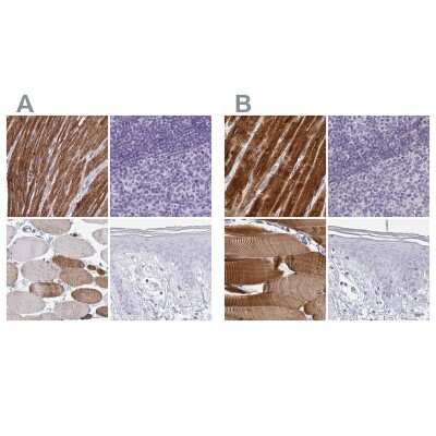 Immunohistochemistry-Paraffin: Calsequestrin 2 Antibody [NBP2-33747]