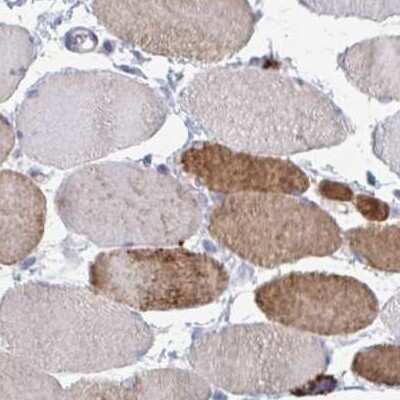 Immunohistochemistry-Paraffin: Calsequestrin 2 Antibody [NBP2-33747]