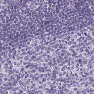 Immunohistochemistry-Paraffin: Calsequestrin 2 Antibody [NBP2-33747]