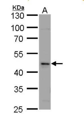 Western Blot: Calsequestrin 2 Antibody [NBP1-32594]