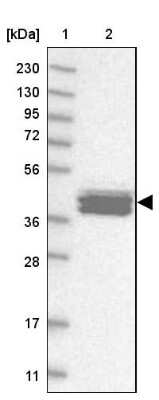 Western Blot: Calsequestrin 2 Antibody [NBP1-87304]