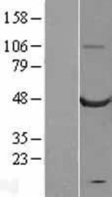 Western Blot: Calsequestrin 2 Overexpression Lysate [NBL1-08720]