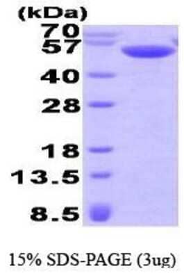 SDS-PAGE: Recombinant Human Calsequestrin 2 His Protein [NBP1-41229]