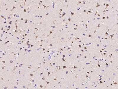 Immunohistochemistry-Paraffin: Calsyntenin-1 Antibody [NBP2-97117]
