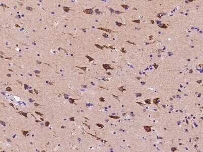 Immunohistochemistry-Paraffin: Calsyntenin-1 Antibody [NBP2-99468]