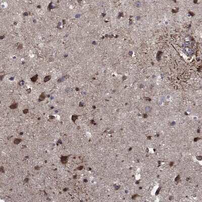 Immunohistochemistry-Paraffin: Calsyntenin-1 Antibody [NBP3-17025]