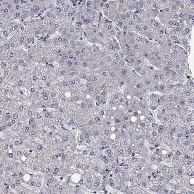 Immunohistochemistry-Paraffin: Calsyntenin-1 Antibody [NBP3-17025]