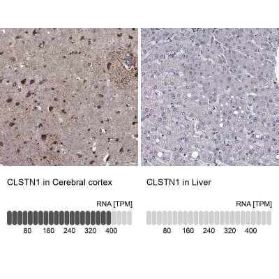 Immunohistochemistry-Paraffin: Calsyntenin-1 Antibody [NBP3-17025]