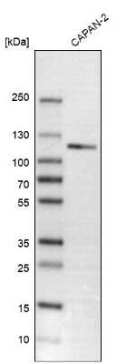 Western Blot: Calsyntenin-1 Antibody [NBP1-85706]