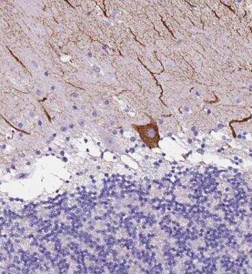 Immunohistochemistry-Paraffin: Calsyntenin-2 Antibody [NBP1-85705]