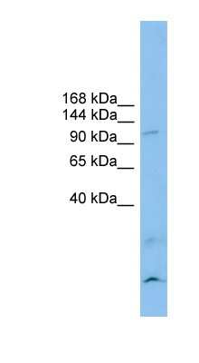 Western Blot: Calsyntenin-3 Antibody [NBP1-59713]