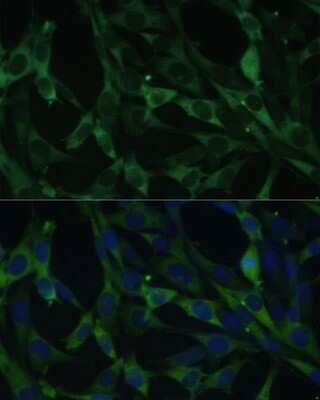 Immunocytochemistry/ Immunofluorescence: Calumenin Antibody - BSA Free [NBP2-92901]