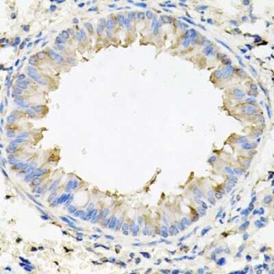 Immunohistochemistry-Paraffin: Calumenin Antibody - BSA Free [NBP2-92901]