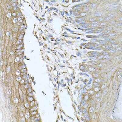 Immunohistochemistry-Paraffin: Calumenin Antibody - BSA Free [NBP2-92901]