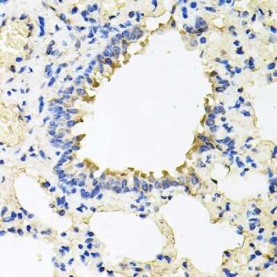 Immunohistochemistry-Paraffin: Calumenin Antibody - BSA Free [NBP2-92901]
