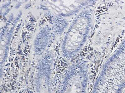 Immunohistochemistry-Paraffin: Calumenin Antibody (S05-1E7) [NBP3-15010]